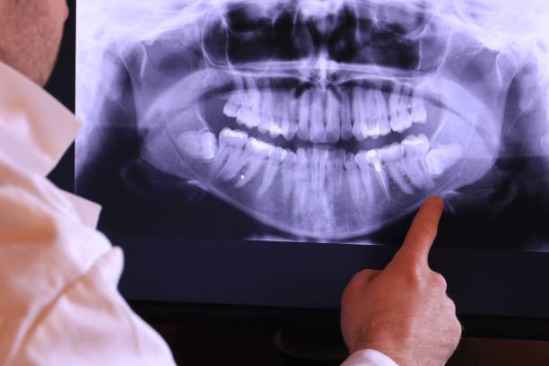 Best Emergency Tooth Extraction in Ferris, TX
