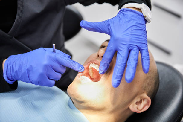 Best Emergency Root Canal Treatment in Ferris, TX