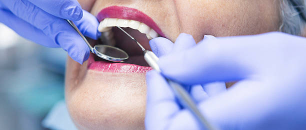 Best Emergency Root Canal Treatment in Ferris, TX